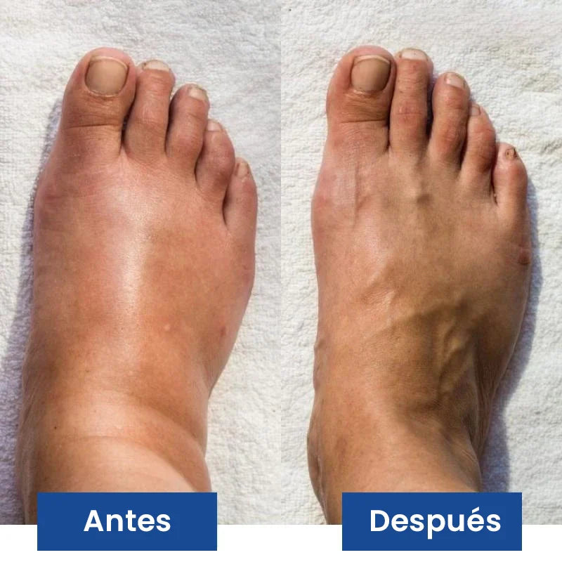 NUEVO Masajeador de Pies PROFESIONAL®