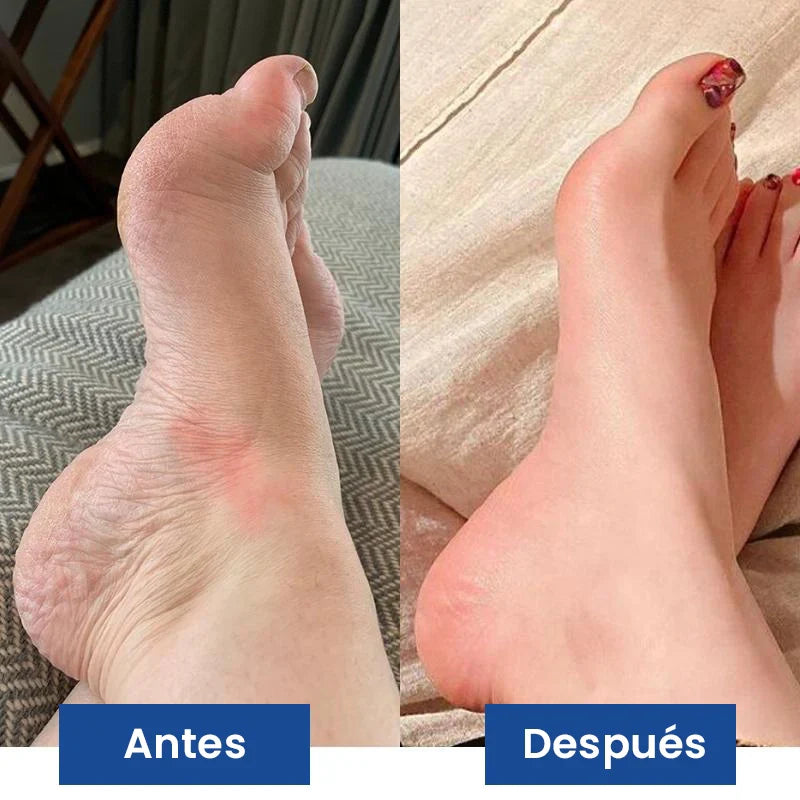 NUEVO Masajeador de Pies PROFESIONAL®