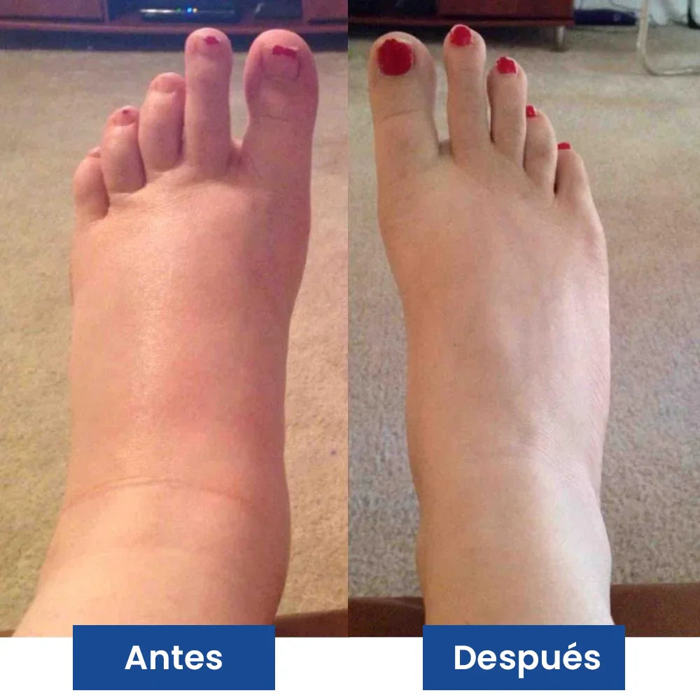 NUEVO Masajeador de Pies PROFESIONAL®