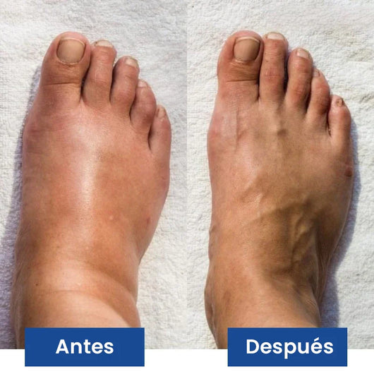 NUEVO Masajeador de Pies PROFESIONAL®